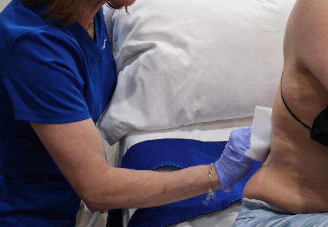 CoolSculpting Elite non-surgical fat reduction treatment in North Scottsdale