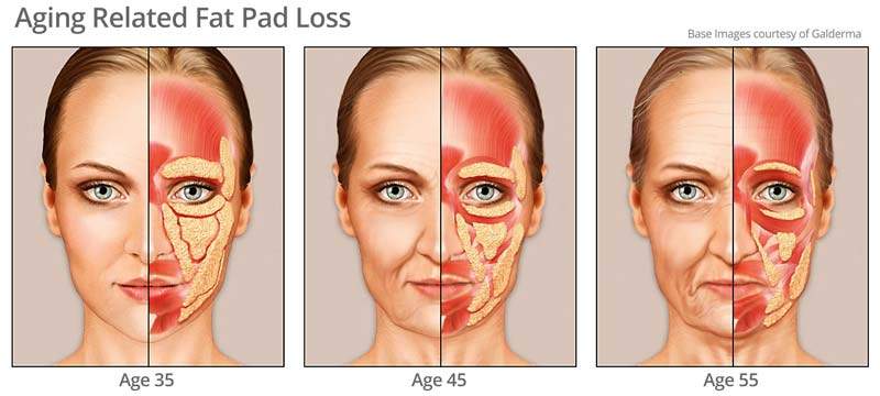 The Aging Face